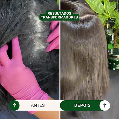 Coleção Oásis Therapy Detox - Profissional
